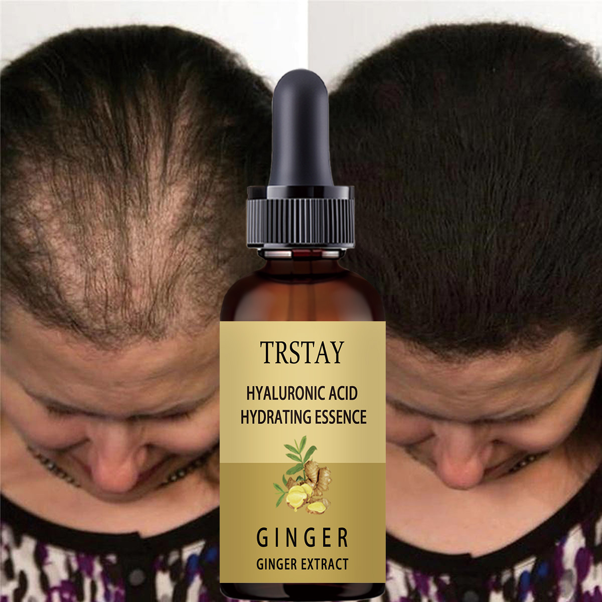 5ML/15ML/30ML/50ML Hair Growth - Perfume Zara recension och pris