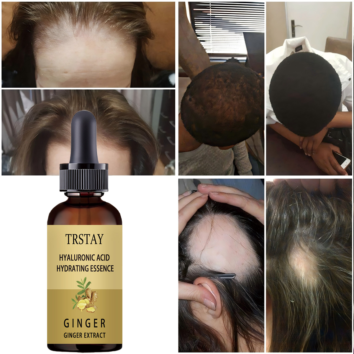 5ML/15ML/30ML/50ML Hair Growth - Perfume Zara recension och pris