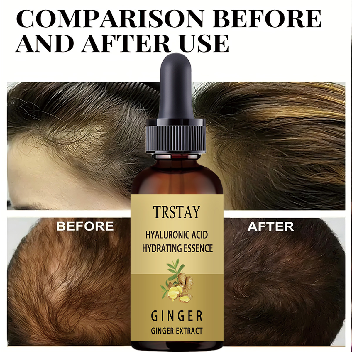 5ML/15ML/30ML/50ML Hair Growth - Perfume Zara recension och pris