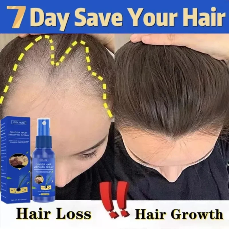 Hair Growth Spray Promote Fast - Perfume Zara recension och pris