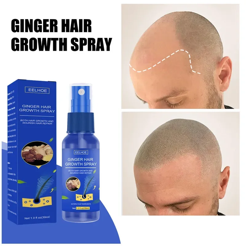 Hair Growth Spray Promote Fast - Perfume Zara recension och pris