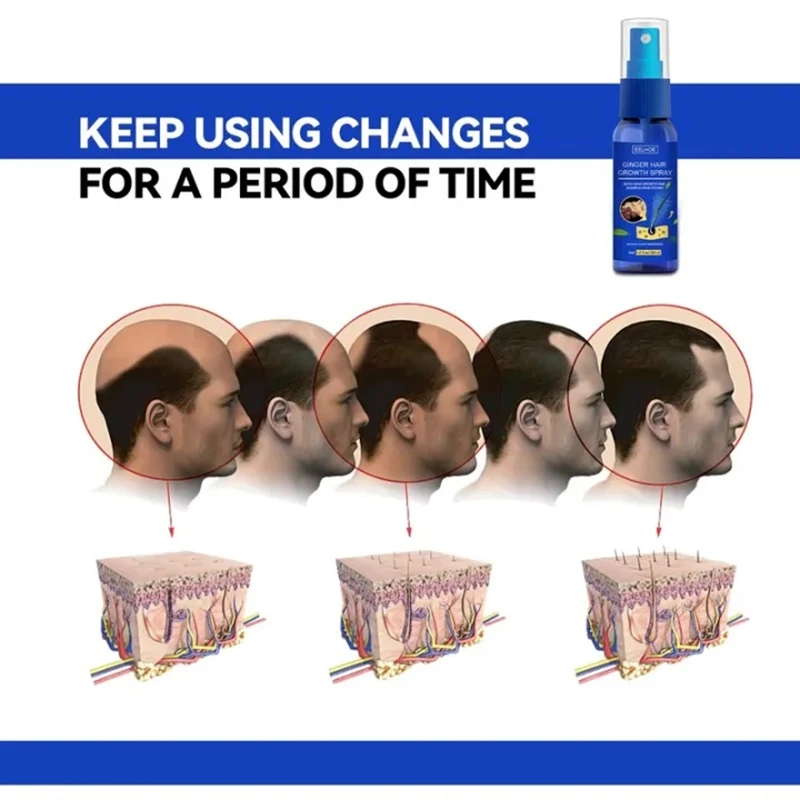 Hair Growth Spray Promote Fast - Perfume Zara recension och pris
